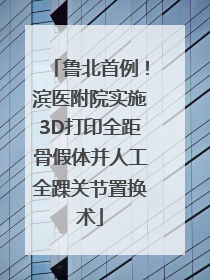鲁北首例！滨医附院实施3D打印全距骨假体并人工全踝关节置换术